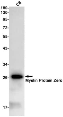 Western Blot: Myelin Protein Zero Antibody (S02-7A2) [NBP3-19706]