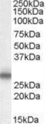 Western Blot: Myelin Protein Zero Antibody [NB100-94909]