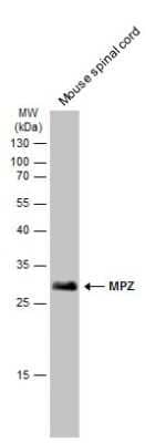 Western Blot: Myelin Protein Zero Antibody [NBP3-13351]