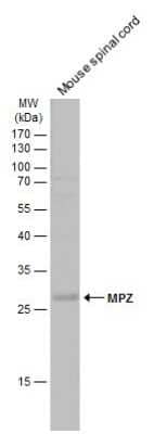 Western Blot: Myelin Protein Zero Antibody [NBP3-13353]