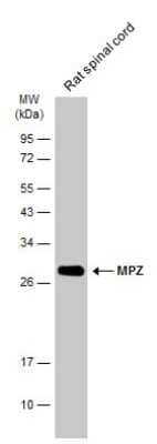 Western Blot: Myelin Protein Zero Antibody [NBP3-13353]