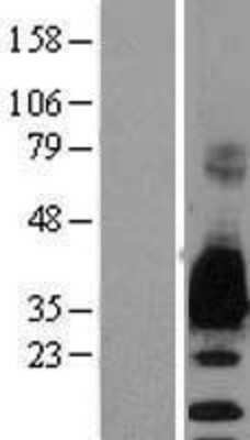 Western Blot: Myelin Protein Zero Overexpression Lysate [NBL1-13213]