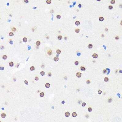 Immunohistochemistry-Paraffin: Myelin expression factor 2 Antibody - Azide and BSA Free [NBP2-93986]