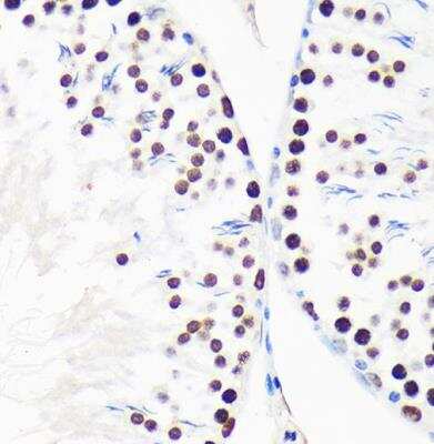 Immunohistochemistry-Paraffin: Myelin expression factor 2 Antibody - Azide and BSA Free [NBP2-93986]