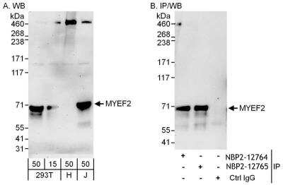 Immunoprecipitation: Myelin expression factor 2 Antibody [NBP2-12764]