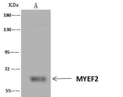 Immunoprecipitation: Myelin expression factor 2 Antibody [NBP3-12682]