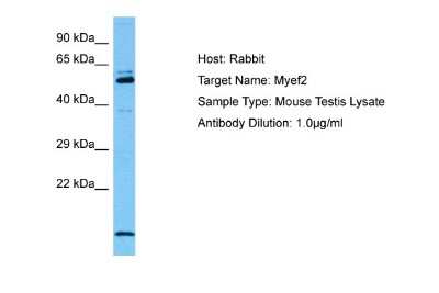 Western Blot: Myelin expression factor 2 Antibody [NBP2-87864]