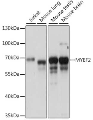 Western Blot: Myelin expression factor 2 AntibodyAzide and BSA Free [NBP2-93986]