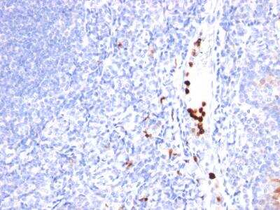 Immunohistochemistry-Paraffin: Myeloid-Associated Differentiation Marker Antibody (MYADM/971) - IHC-Prediluted [NBP2-48435]