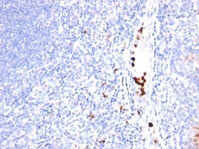 Immunohistochemistry-Paraffin: Myeloid-Associated Differentiation Marker Antibody (MYADM/971) [NBP2-44358]