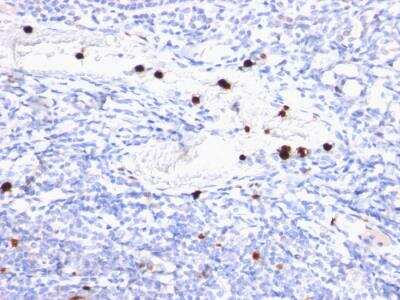 Immunohistochemistry-Paraffin: Myeloid-Associated Differentiation Marker Antibody (MYADM/972) - IHC-Prediluted [NBP2-48442]