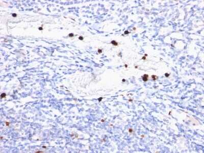 Immunohistochemistry-Paraffin: Myeloid-Associated Differentiation Marker Antibody (MYADM/972) [NBP2-44359]