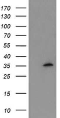 Western Blot: Myeloid leukemia factor 1 Antibody (OTI3F11) [NBP2-45866]