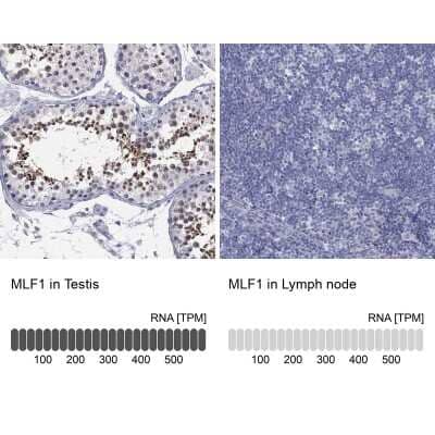 Immunocytochemistry/ Immunofluorescence: Myeloid leukemia factor 1 Antibody [NBP3-17083]