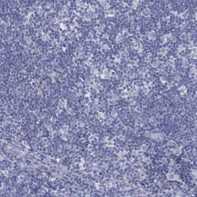 Immunohistochemistry-Paraffin: Myeloid leukemia factor 1 Antibody [NBP3-17083]