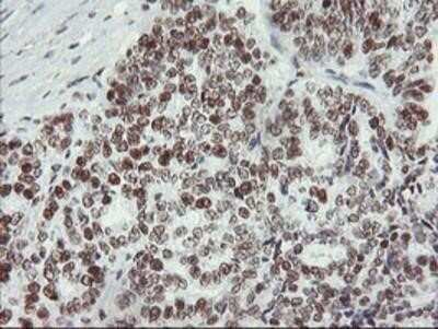 Immunohistochemistry: Myeloid leukemia factor 1 Antibody (OTI3A3) - Azide and BSA Free [NBP2-72846]