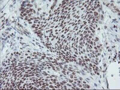 Immunohistochemistry: Myeloid leukemia factor 1 Antibody (OTI3A3) - Azide and BSA Free [NBP2-72846]