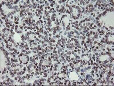 Immunohistochemistry: Myeloid leukemia factor 1 Antibody (OTI3A3) - Azide and BSA Free [NBP2-72846]