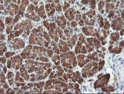 Immunohistochemistry: Myeloid leukemia factor 1 Antibody (OTI3A3) - Azide and BSA Free [NBP2-72846]