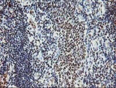Immunohistochemistry: Myeloid leukemia factor 1 Antibody (OTI3A3) - Azide and BSA Free [NBP2-72846]