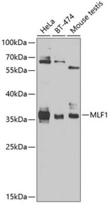 Western Blot: Myeloid leukemia factor 1 AntibodyBSA Free [NBP2-93724]