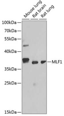 Western Blot: Myeloid leukemia factor 1 AntibodyBSA Free [NBP2-93971]