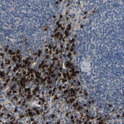 Immunohistochemistry: Myeloperoxidase/MPO Antibody [NBP1-87556]