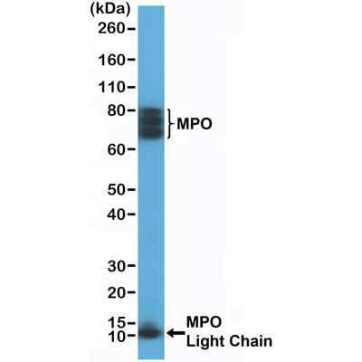 Western Blot: Myeloperoxidase/MPO Antibody (RM407) [NBP2-89098]