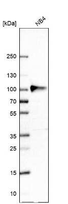 Western Blot: Myeloperoxidase/MPO Antibody [NBP2-38922]