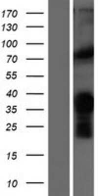 Western Blot: MYF-5 Overexpression Lysate [NBP2-07728]