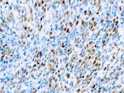 Immunohistochemistry-Paraffin: MyoD Antibody (5.2F) [NB120-788]