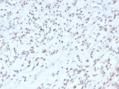 Immunohistochemistry-Paraffin: MyoD Antibody (MYOD1/2075R) - Azide and BSA Free [NBP2-75772]