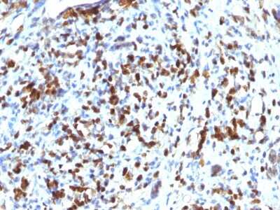 Immunohistochemistry-Paraffin: MyoD Antibody (MYOD1/2075R) - Azide and BSA Free [NBP2-75772]