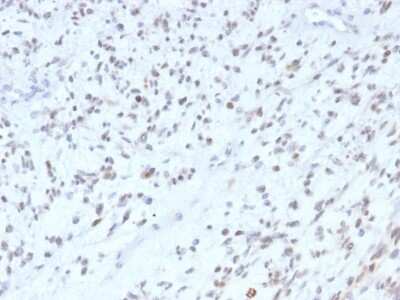 Immunohistochemistry-Paraffin: MyoD Antibody (MYOD1/2075R) [NBP2-75769]