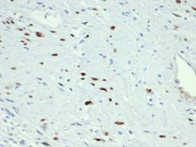 Immunohistochemistry-Paraffin: MyoD Antibody (MYOD1/3418R) - Azide and BSA Free [NBP3-08543]