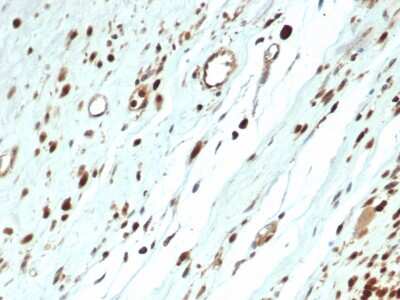 Immunohistochemistry-Paraffin: MyoD Antibody (MYOD1/3418R) - Azide and BSA Free [NBP3-08543]