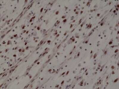 Immunohistochemistry-Paraffin: MyoD Antibody (RM369) [NBP2-77430]