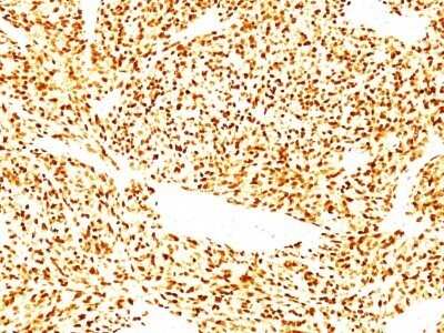 Immunohistochemistry-Paraffin: MyoD Antibody (SPM427) - Azide and BSA Free [NBP2-34772]