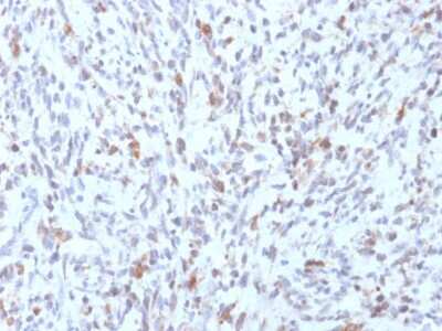 Immunohistochemistry-Paraffin: MyoD Antibody (rMYD712) [NBP3-07394]