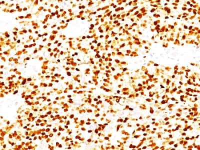 Immunohistochemistry-Paraffin: MyoD Antibody (MYD712) [NBP2-32883]