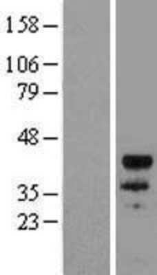 Western Blot: MyoD Overexpression Lysate [NBL1-13443]