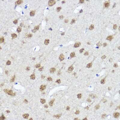 Immunohistochemistry-Paraffin: Myocardin Antibody - Azide and BSA Free [NBP2-93064]