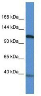 Western Blot: Myocardin Antibody [NBP1-74113]