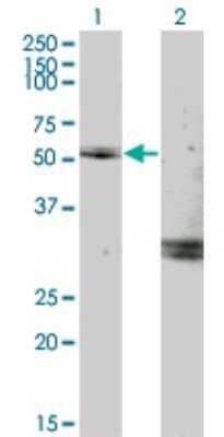 Western Blot: Myocilin Antibody (2B4) [H00004653-M02]