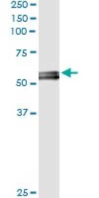 Immunoprecipitation: Myocilin Antibody (4F8) [H00004653-M01]