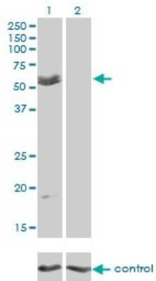 Western Blot: Myocilin Antibody (4F8) [H00004653-M01]