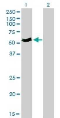 Western Blot: Myocilin Antibody (4F8) [H00004653-M01]