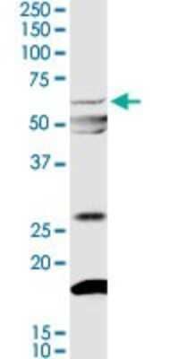 Western Blot: Myocilin Antibody [H00004653-D01P]