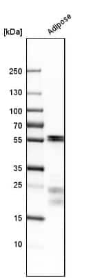 Western Blot: Myocilin Antibody [NBP1-89769]