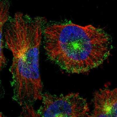 Immunocytochemistry/ Immunofluorescence: Myoferlin Antibody [NBP1-84694]
